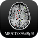 影像解剖图谱 影像解剖图谱